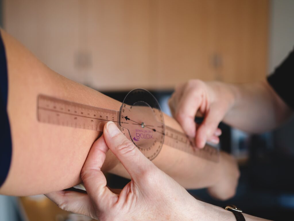 Measuring the arm angle - Newcastle Medical Genetics